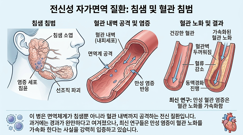 쇼그렌증후군 전신 자가면역 질환 설명