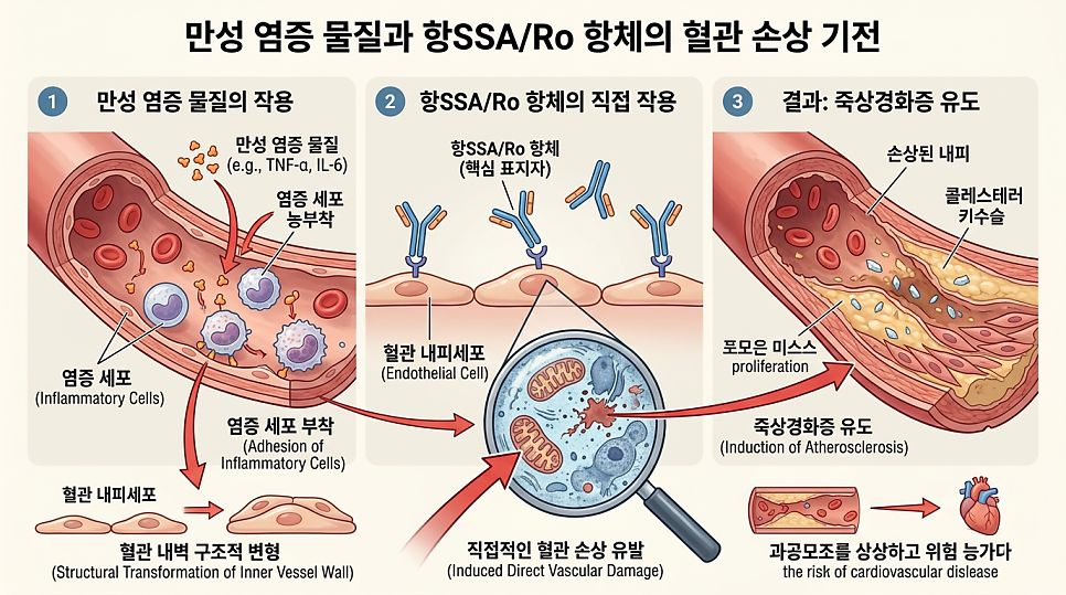 항SSA/Ro 항체의 혈관 내피세포 손상 경로