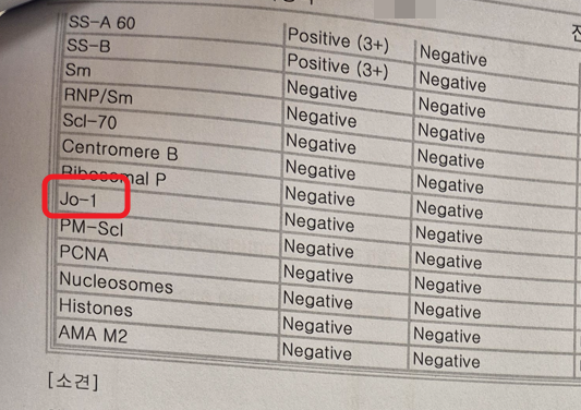 항합성효소증후군 진단 기준