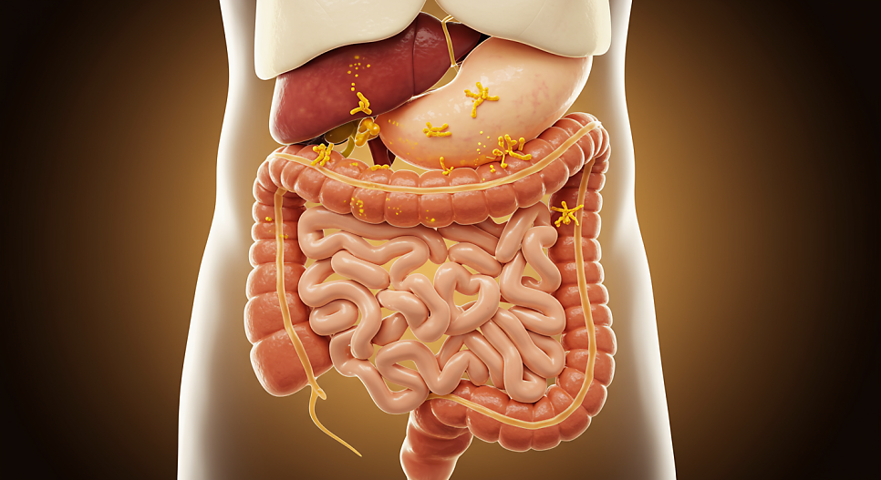 장내 세균 불균형 메커니즘