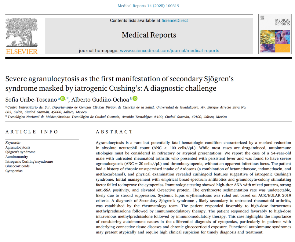 쇼그렌증후군 스테로이드 치료 관리