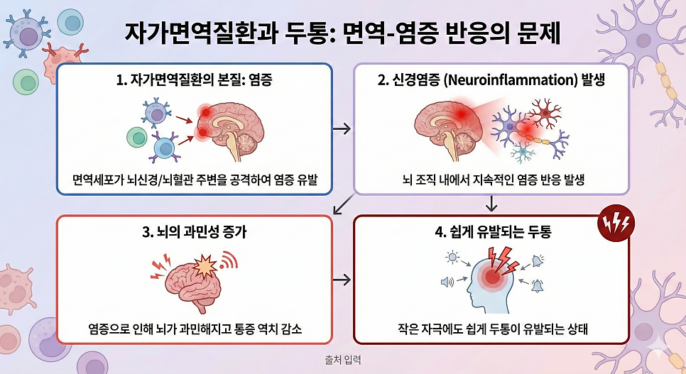 쇼그렌증후군 두통 치료 접근법