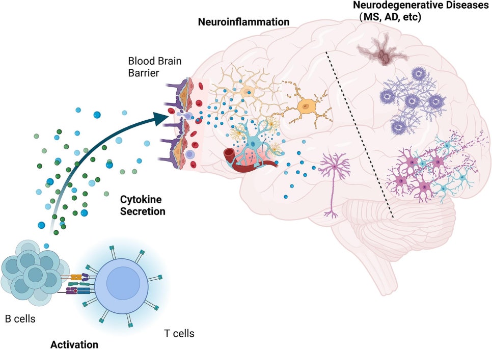 신경계 자가면역 반응 도식