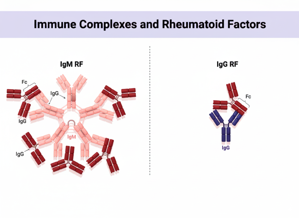 RF 양성의 임상적 의미 도식