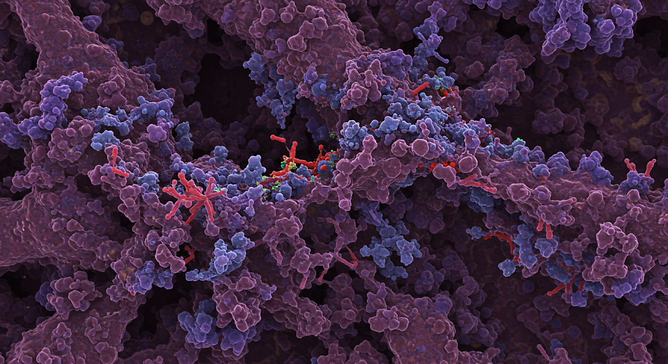 혈관염과 일반 두드러기 차이