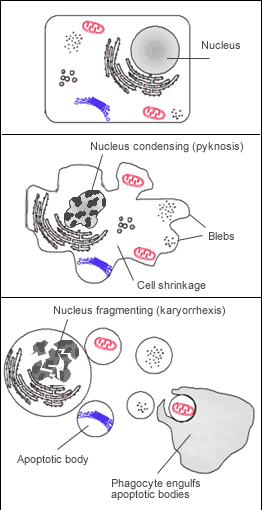 쇼그렌 증후군 apoptosis란? 인천 이레 한의원