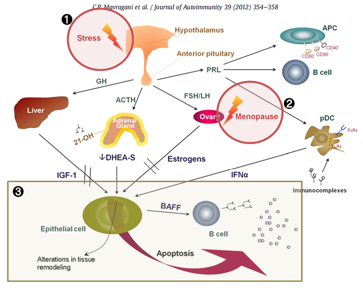 쇼그렌증후군 한의원 치료의 원리, 인천 이레 한의원