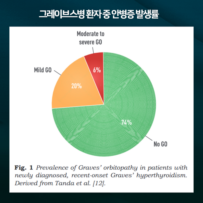 그레이브스병 환자 중 갑상선 안병증 발생률