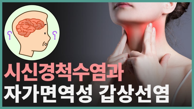 시신경척수염과 하시모토갑상선염 그레이브스병의 관련성은 어느 정도