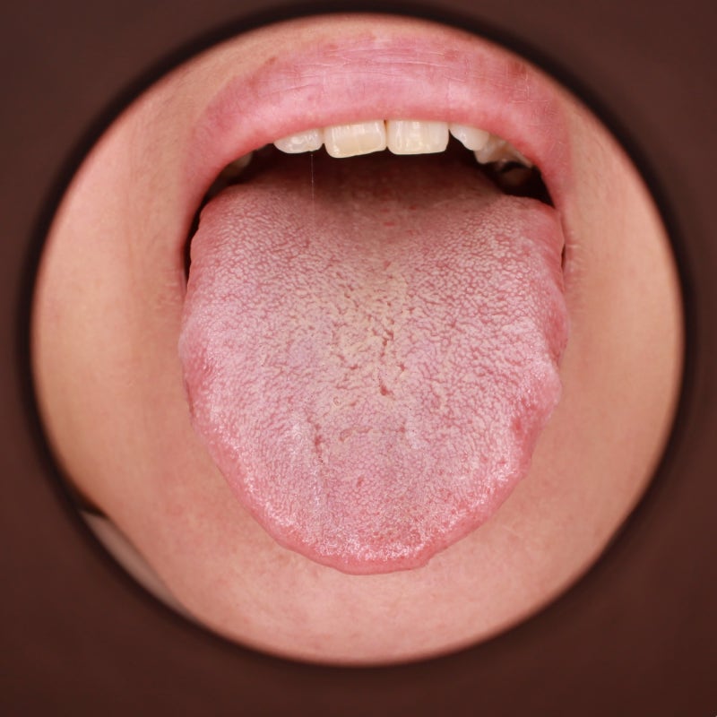 하시모토 갑상선염 치료 후 수치가 정상이 되었더라고 이것을 주의해야