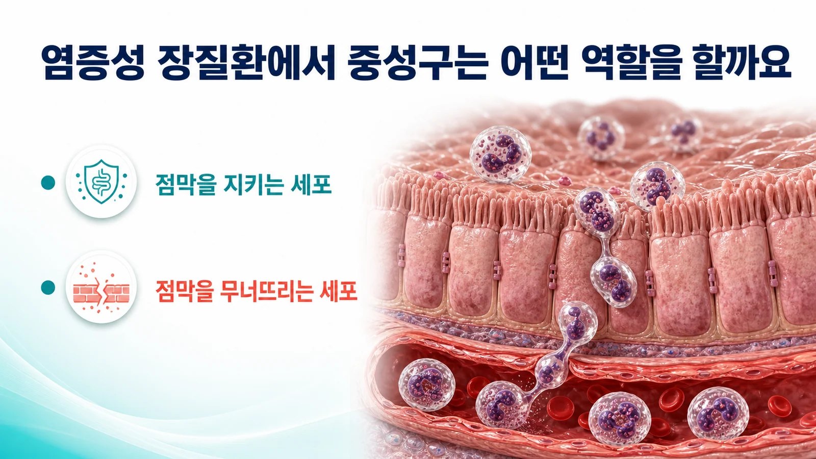 염증성 장질환에 있어서 중성구의 역할, 염증이 쉽게 가라앉지 않을 때