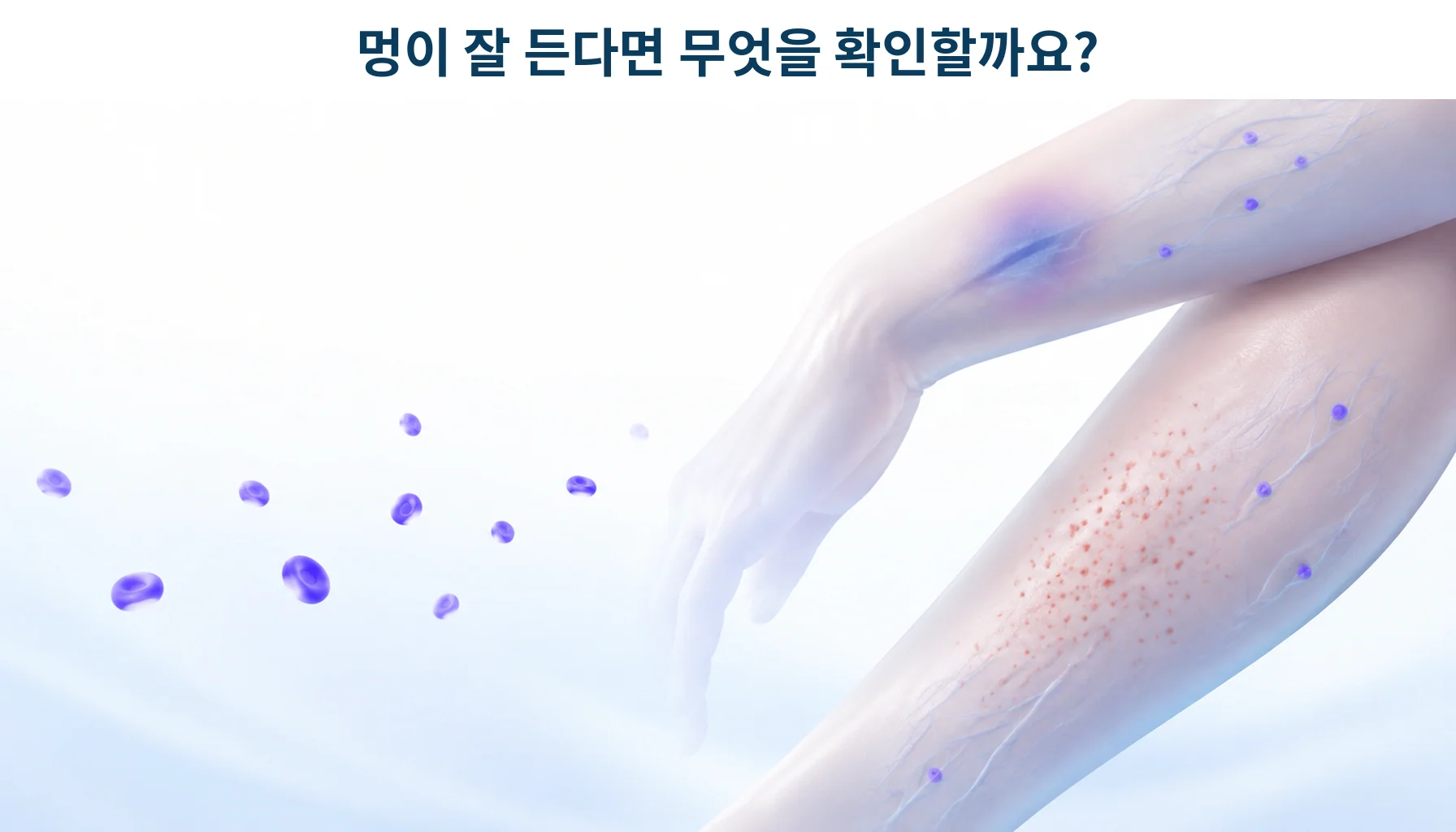 혈소판감소증의 원인과 악화 요인, 미리 알 수 있는 신호가 있을까요