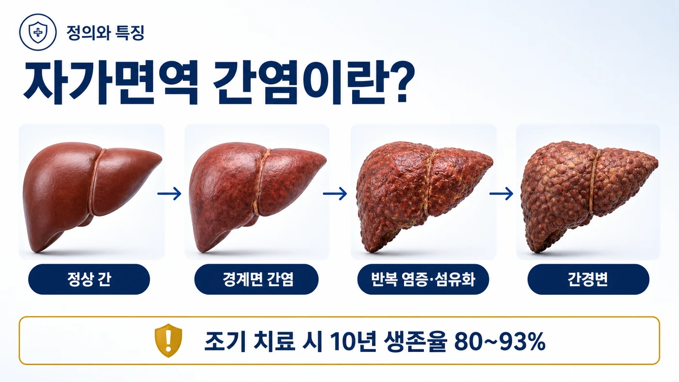자가면역 간염이란 — 정상 간에서 경계면 간염, 반복 염증과 섬유화를 거쳐 간경변으로 진행할 수 있으며 조기 치료 시 10년 생존율 80~93%