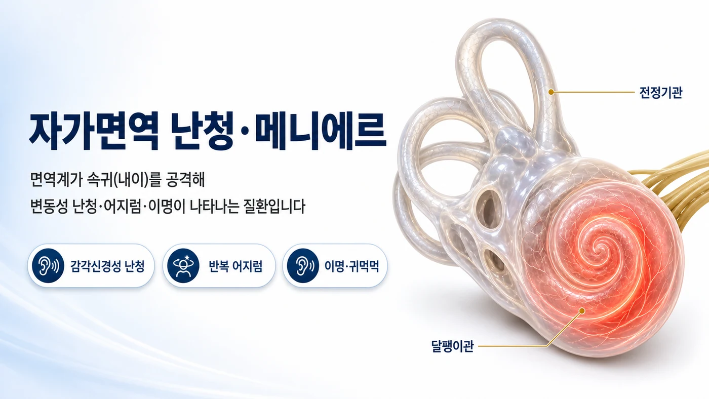 자가면역 난청·메니에르 대표 이미지. 면역계가 속귀(내이)를 공격해 변동성 난청·어지럼·이명이 나타나는 질환임을 달팽이관과 전정기관 구조로 보여줍니다.