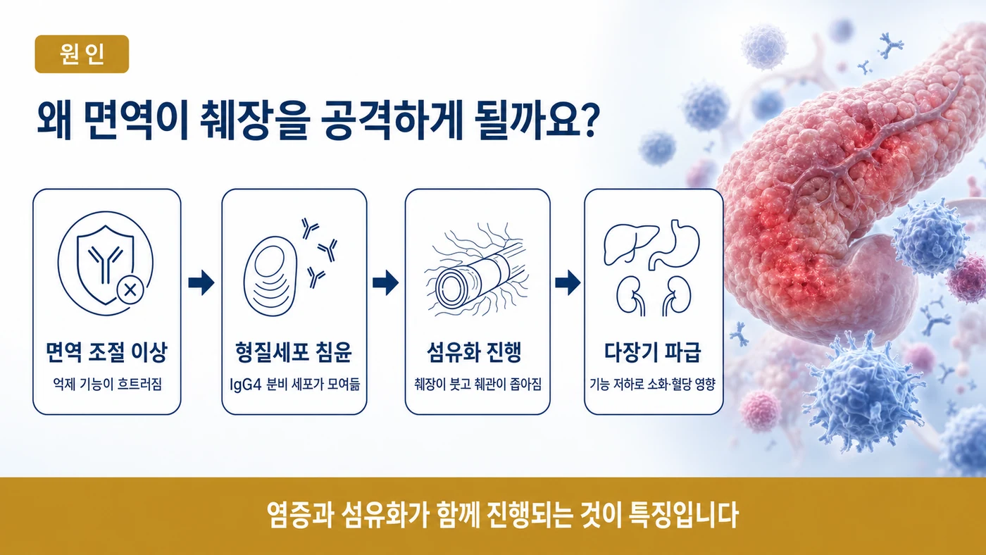 면역 조절 이상에서 형질세포 침윤, 섬유화 진행, 다장기 파급으로 이어지는 자가면역 췌장염의 진행 단계