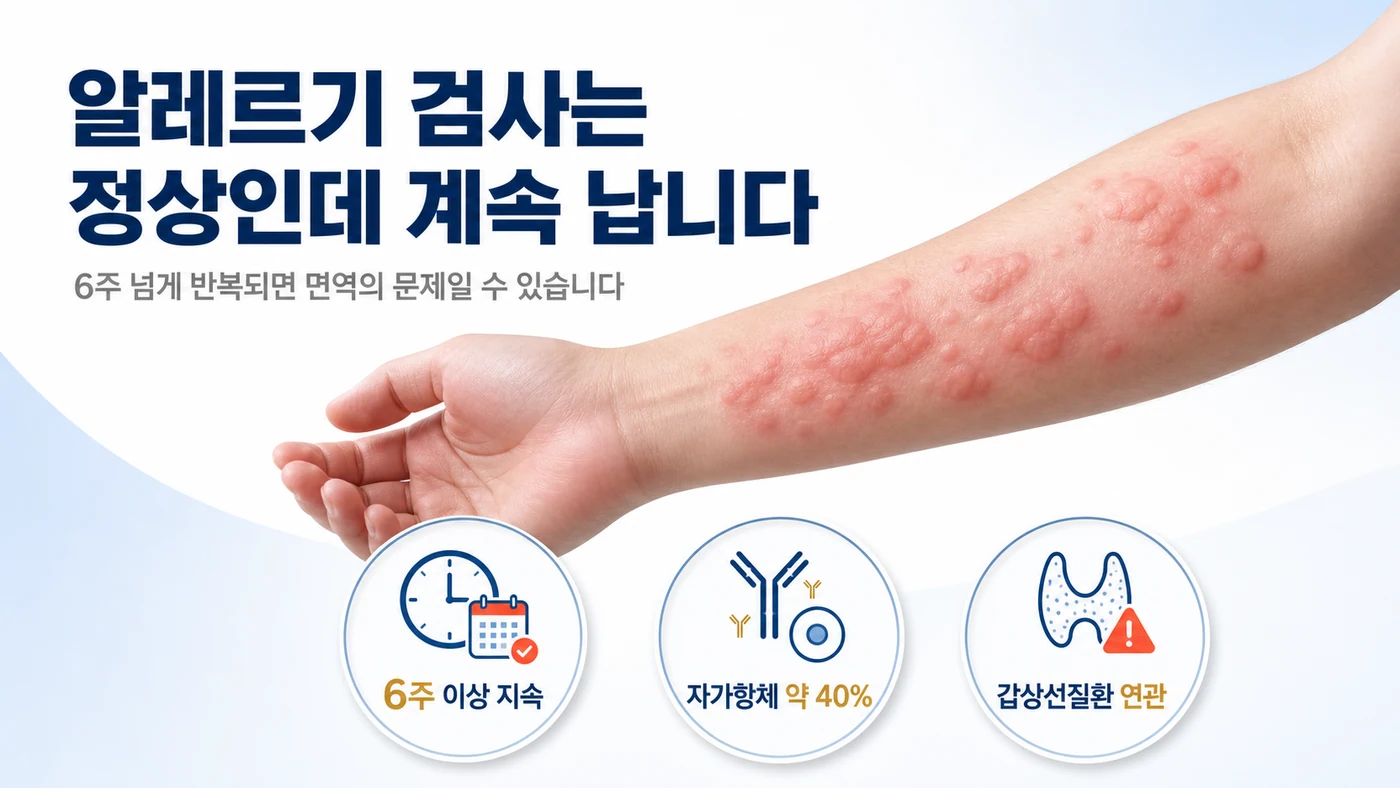 알레르기 검사가 정상인데 6주 넘게 반복되는 만성 두드러기