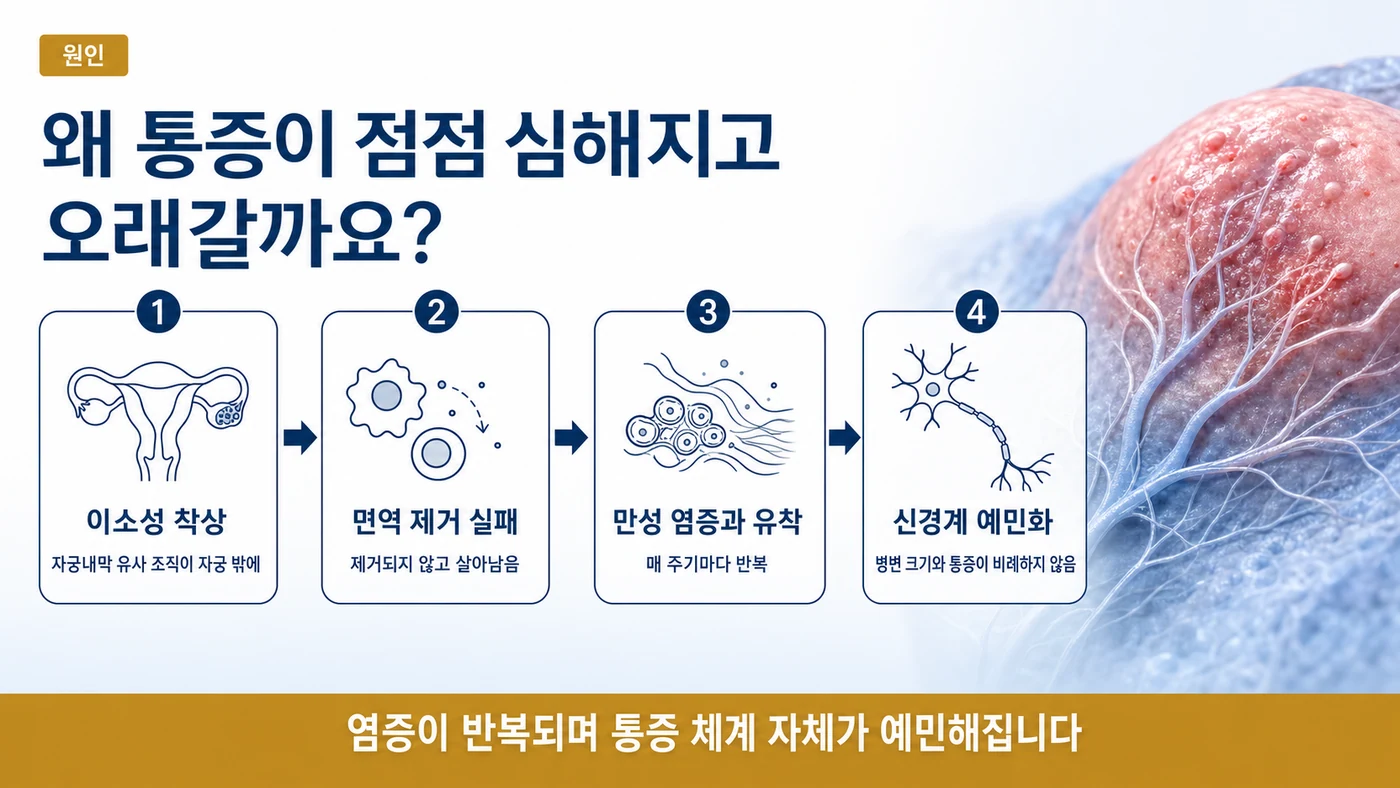 이소성 착상에서 면역 제거 실패, 만성 염증과 유착, 통증 신경계 예민화로 이어지는 자궁내막증의 진행 단계