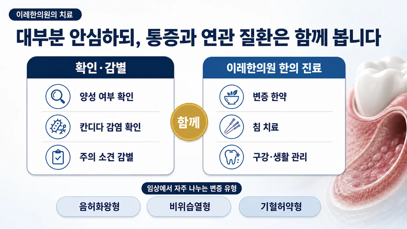 지도설·균열설 관리 — 대부분 양성임을 확인하고 칸디다 감염·주의 소견을 감별하며 이레한의원의 변증 한약·침·구강 생활 관리를 함께하고 음허화왕형·비위습열형·기혈허약형으로 변증