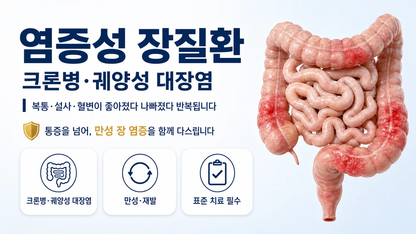 염증성 장질환 안내 — 크론병·궤양성 대장염으로 복통·설사·혈변이 호전과 악화를 반복하는 만성 자가면역 장 질환