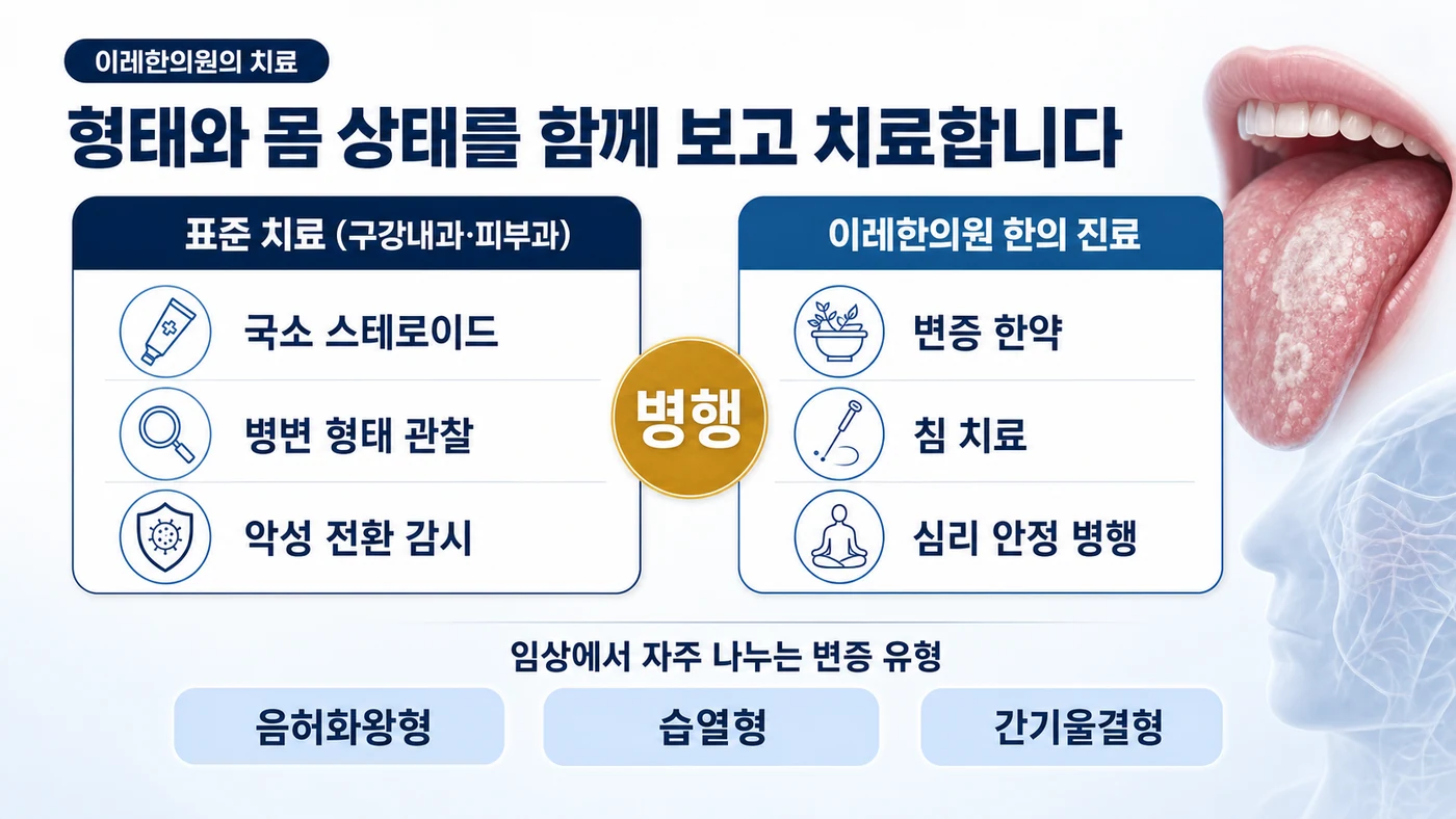 구강 편평태선 치료 — 구강내과·피부과의 국소 스테로이드·병변 관찰·악성 전환 감시와 이레한의원의 변증 한약·침·심리 안정을 병행하며 음허화왕형·습열형·간기울결형으로 변증
