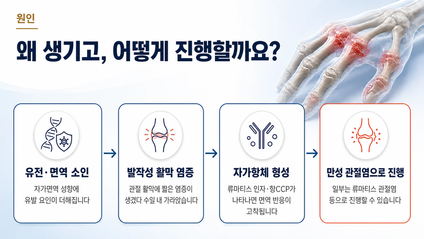 재발성 류마티즘의 원인 — 유전·면역 소인에서 발작성 활막 염증, 자가항체 형성을 거쳐 일부가 만성 관절염으로 진행하는 과정