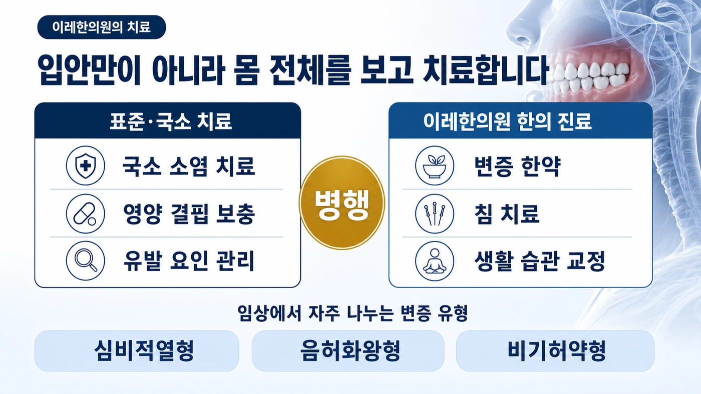 재발성 아프타성 구내염 치료 — 표준·국소 소염 치료와 영양 결핍 보충·유발 요인 관리, 이레한의원의 변증 한약·침·생활 습관 교정을 병행하며 심비적열형·음허화왕형·비기허약형으로 변증